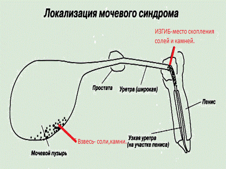 Уретральный синдром. Промежностная уретростомия ход операции. Операция у кота уретростомия. Уретральный катетер для кота схема. Уретростомия кота схема.