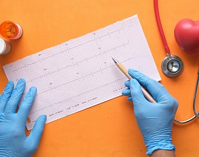 ЭКГ для домашних животных: когда это необходимо